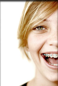 stock photo of a teen girl with braces