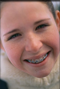 stock photo of a girl with braces